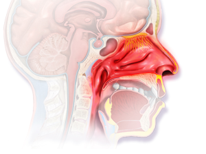 Side view of allergic rhinitis